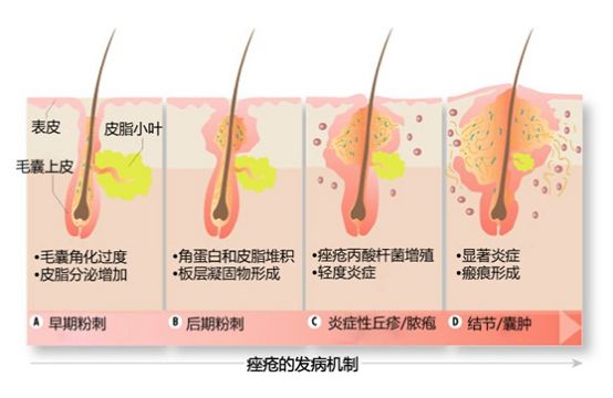 锻炼对抗衰老_运动抗衰老原理_运动可以抗衰老吗